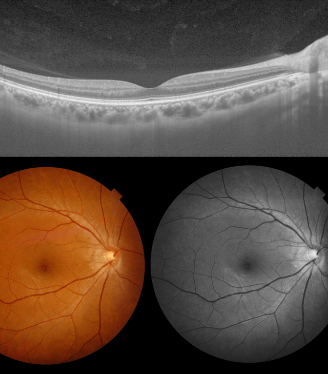Advanced OCT retinal scan and Optomap imaging used for specialist eye examinations at Daybell & Choo Sheffield
